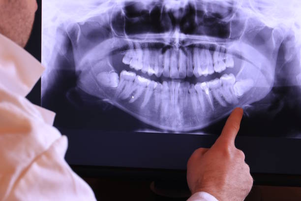 Best Emergency Dental Services for Seniors in Converse, TX
