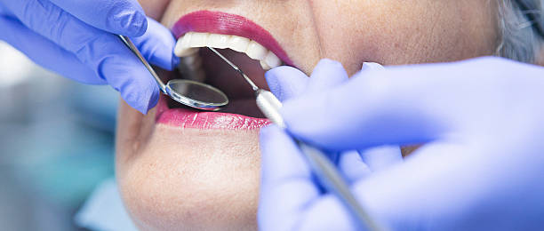 Best Emergency Dentist for Lost Fillings or Crowns in Converse, TX